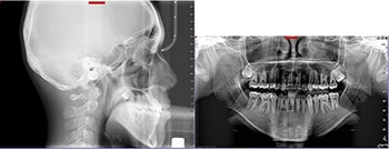 Iatrogenic Challenges