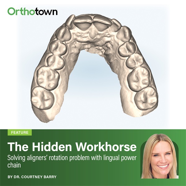 The Hidden Workhorse