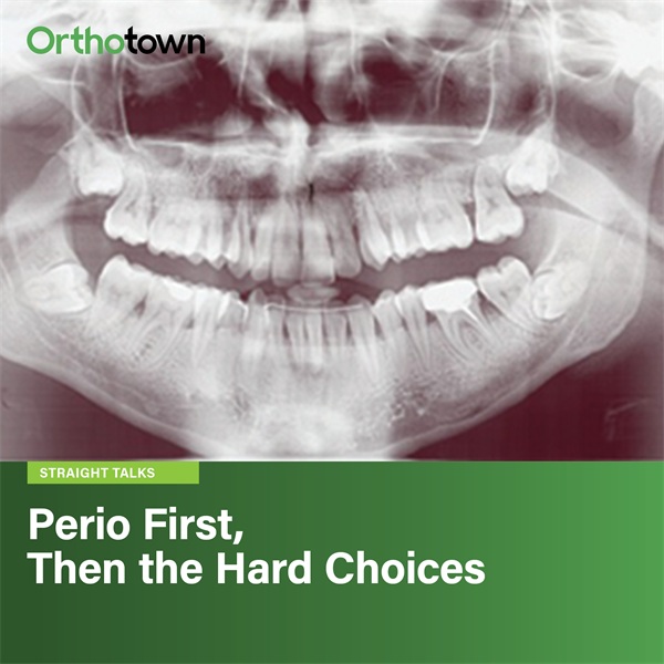 Perio First, Then the Hard Choices