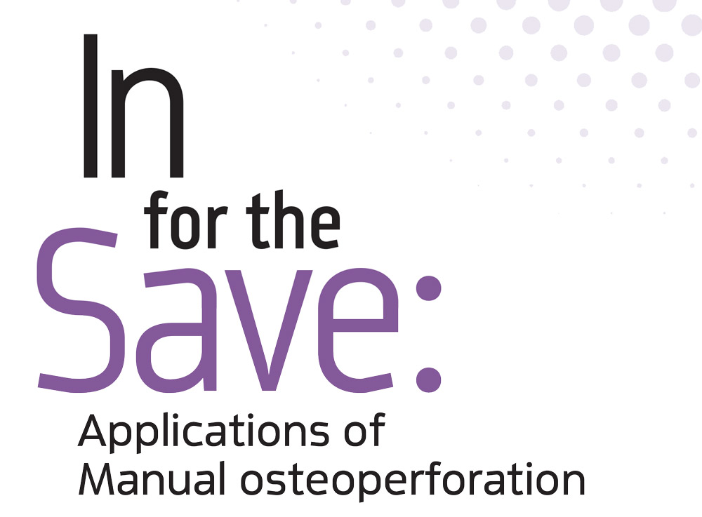 Material Classification and Shade Selection Protocol for All-Ceramic Restorations