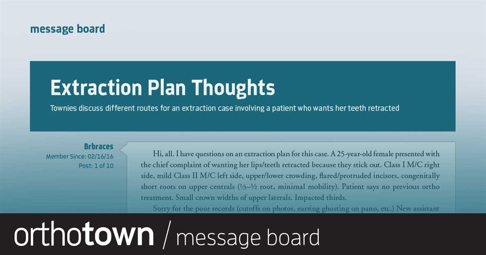 Extraction Plan Thoughts