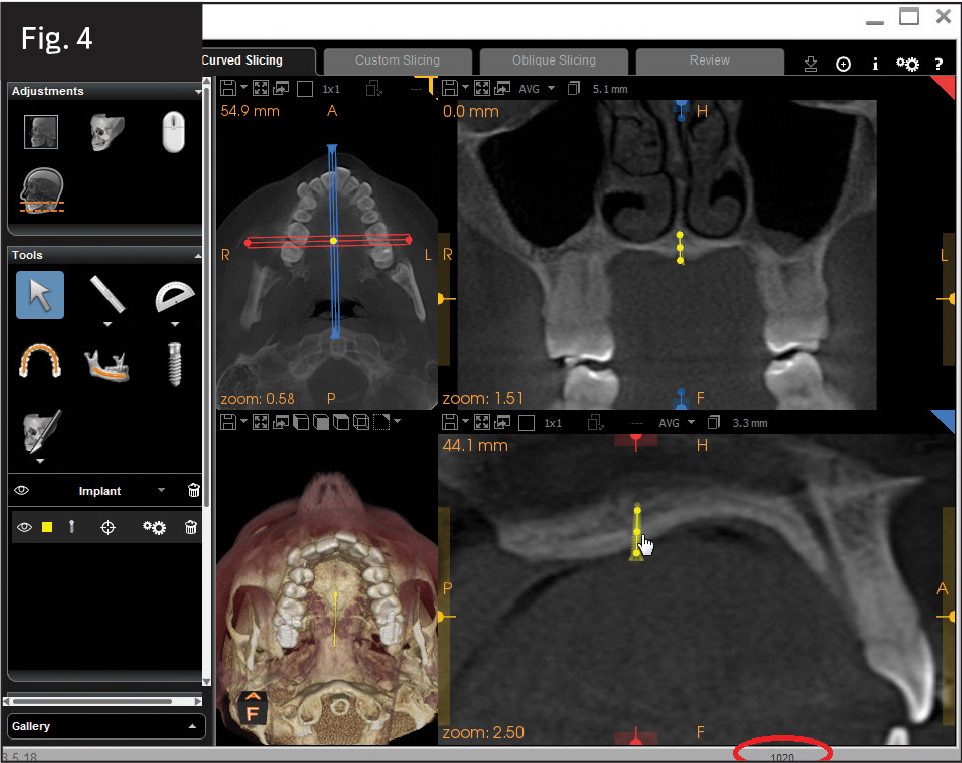 Fig. 4