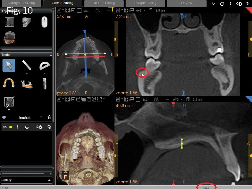 Fig. 10