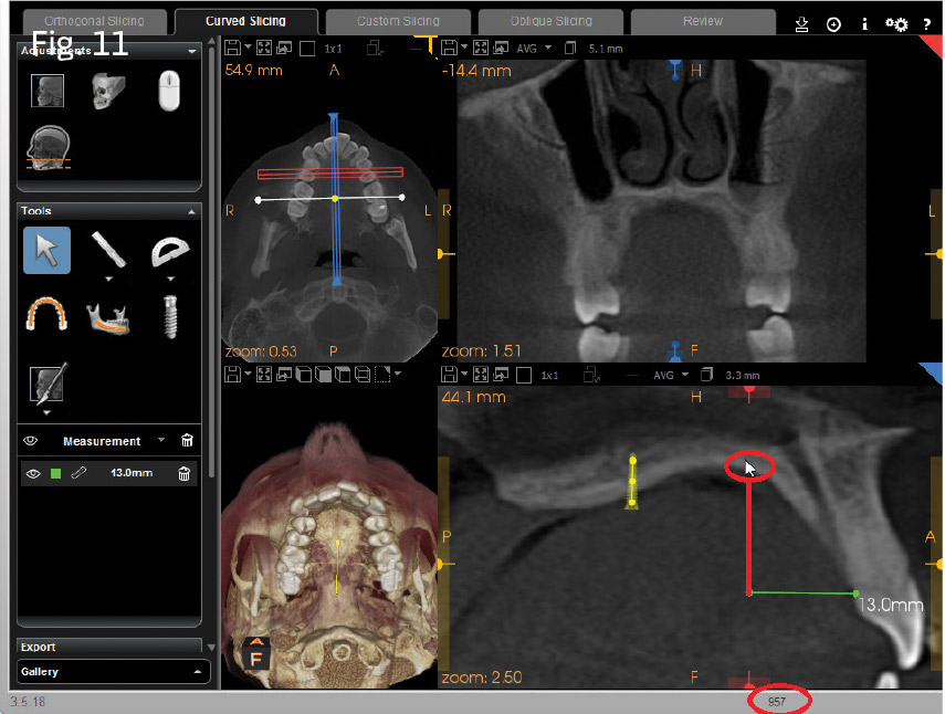 Fig. 11