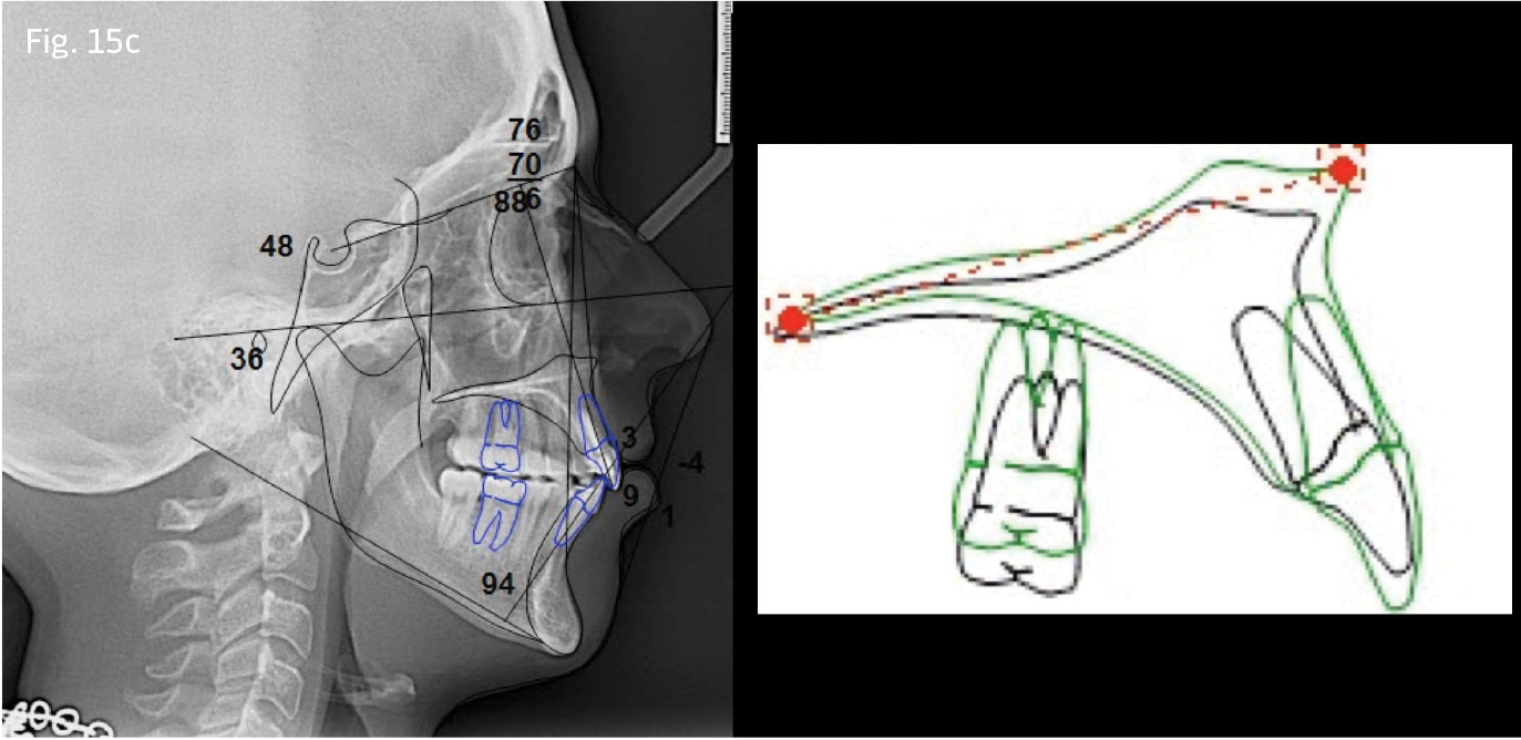 Fig. 15c