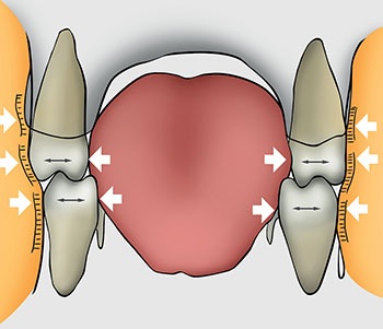 Understanding Oral Facial Habits