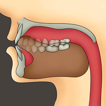 Understanding Oral Facial Habits