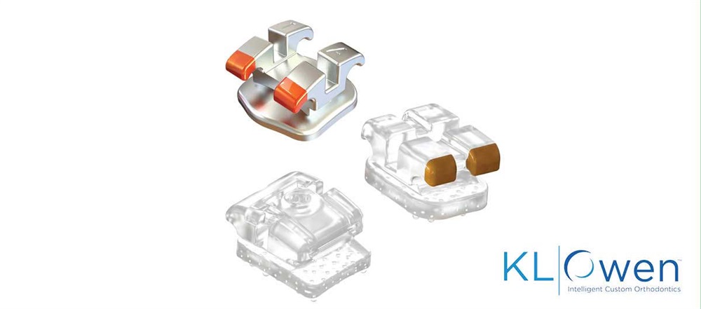 Product Profile: Stride Custom Braces