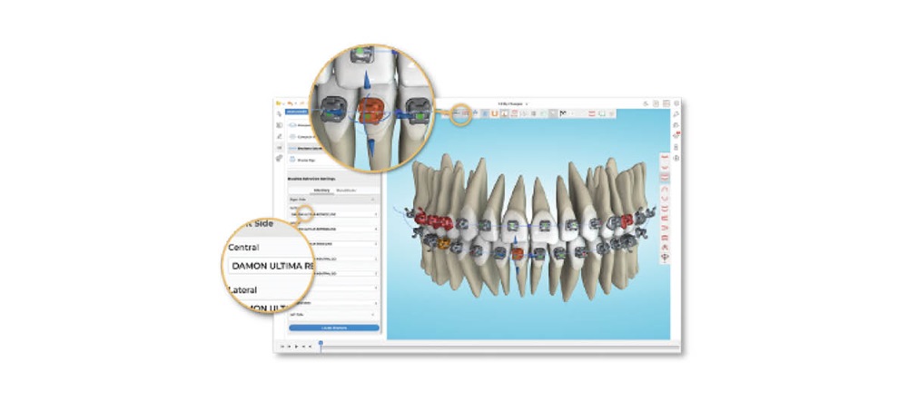 Earned Placement: The Quest for Orthodontic Excellence