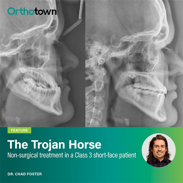 The Trojan Horse