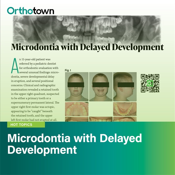 Microdontia with Delayed Development 