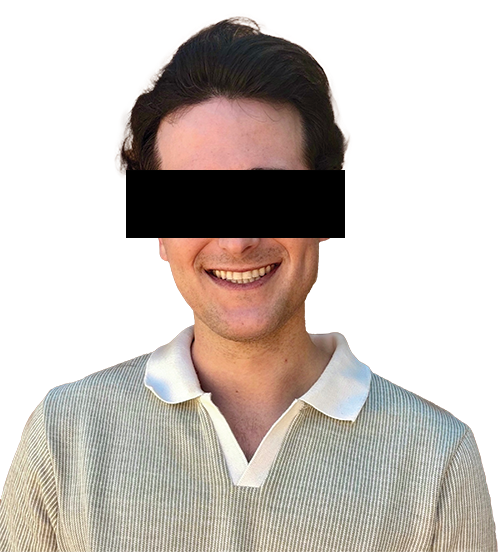 The Power of Anterior-Posterior Control with Clear Aligners