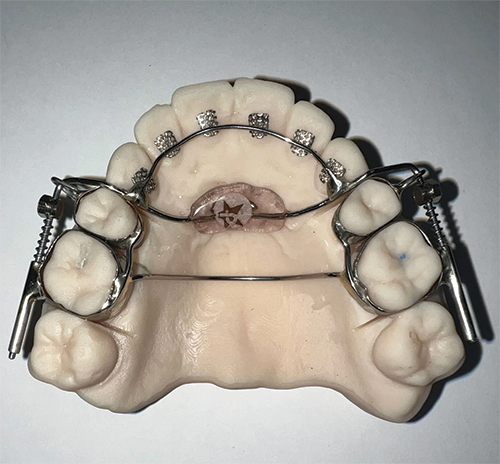 Ignoring Biological Limitations