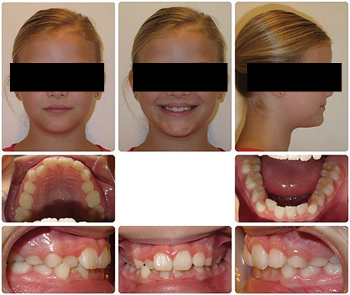 When to Step In (and When to Step Back) in Phase I Treatment