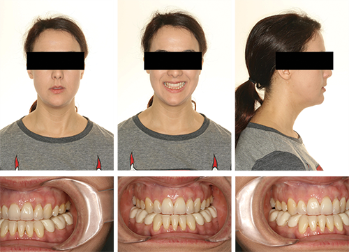 Ignoring Biological Limitations