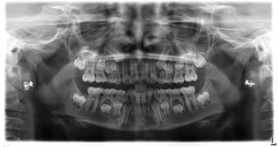 When to Step In (and When to Step Back) in Phase I Treatment