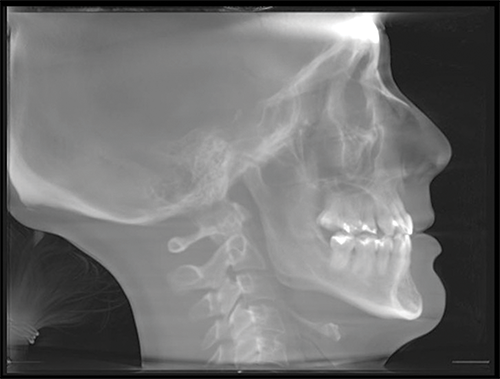 Ignoring Biological Limitations