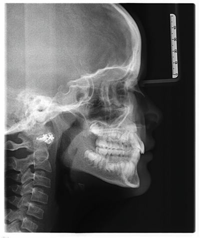 When to Step In (and When to Step Back) in Phase I Treatment