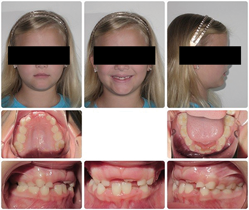 When to Step In (and When to Step Back) in Phase I Treatment