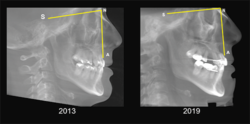 Ignoring Biological Limitations