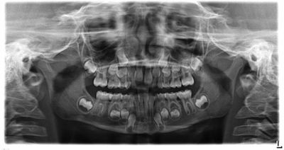 When to Step In (and When to Step Back) in Phase I Treatment