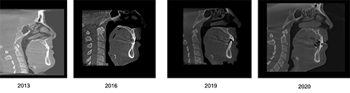 Ignoring Biological Limitations