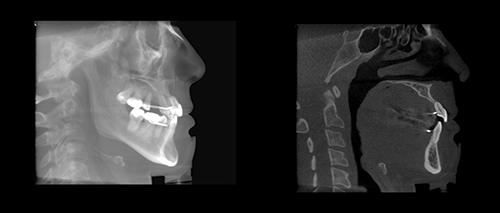 Ignoring Biological Limitations