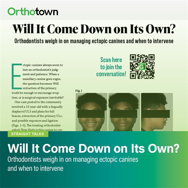 Will It Come Down on Its Own?