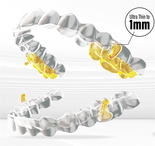 Smartee Sleep Aligners