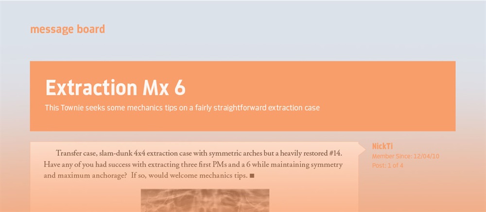 Extraction Mx 6