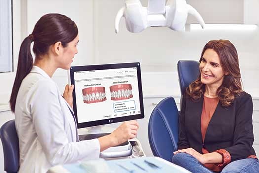 SureSmile Simulator