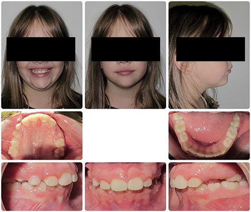Managing a 9-Year-Old Patient Missing 5s and 7s