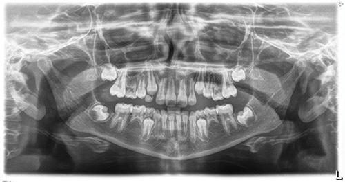 Managing a 9-Year-Old Patient Missing 5s and 7s