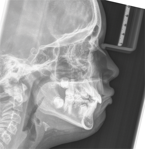 Managing a 9-Year-Old Patient Missing 5s and 7s