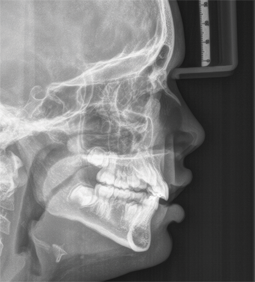 Managing a 9-Year-Old Patient Missing 5s and 7s