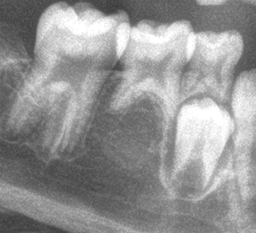 Managing a 9-Year-Old Patient Missing 5s and 7s