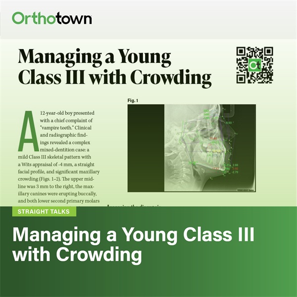 Managing a Young Class III with Crowding